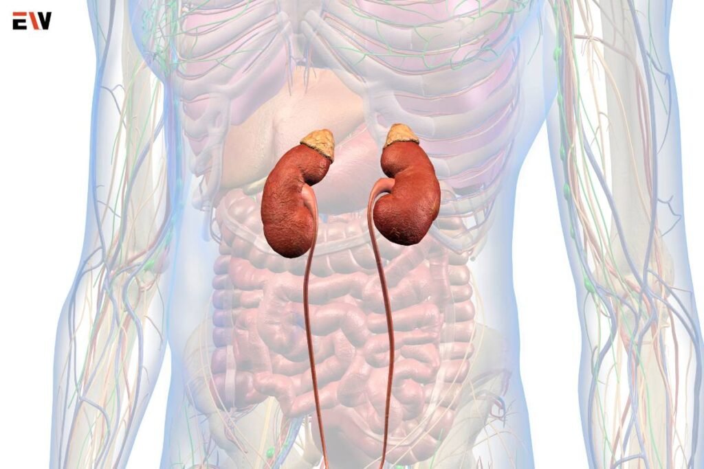 Understanding IgA Nephropathy Symptoms: A Comprehensive Guide